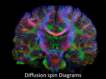Brain wiring diagram made by high-definition fiber tracking magnetic resonance imaging (HDFT MRI) of water diffusion. The technique is useful for studies of traumatic brain injury. Credit: Sudhir Pathak & Walter Schneider/University of Pittsburgh
